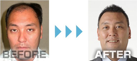 ba.png