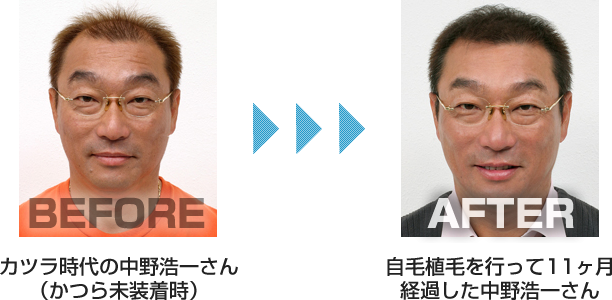naka.png